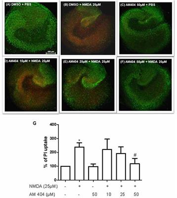 Neuroprotective Effect of AM404 Against NMDA-Induced Hippocampal Excitotoxicity